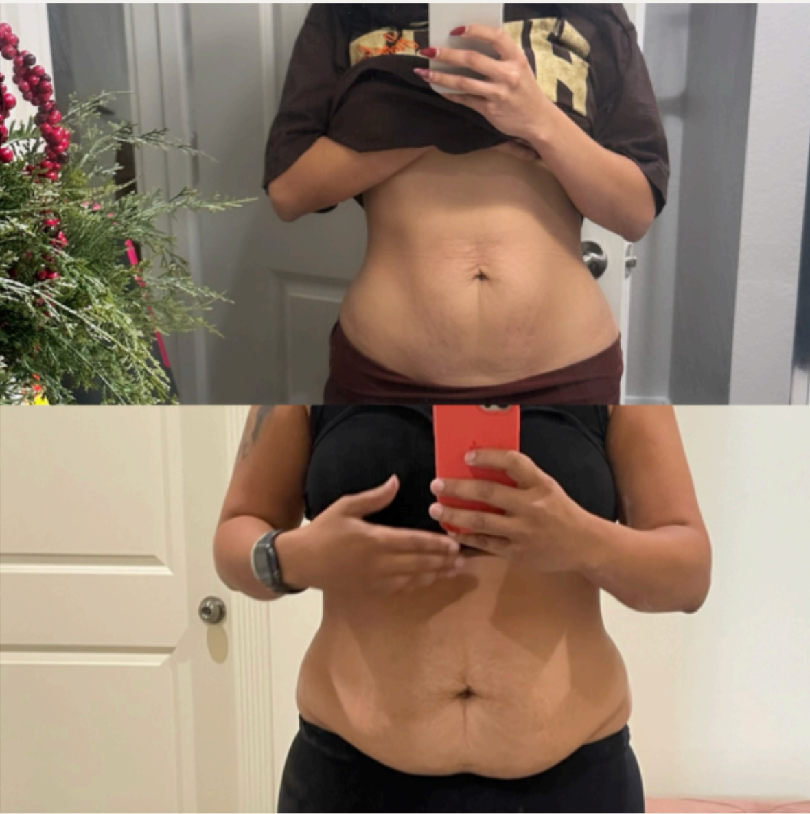 Refined Mommy Makeover 6 sessions