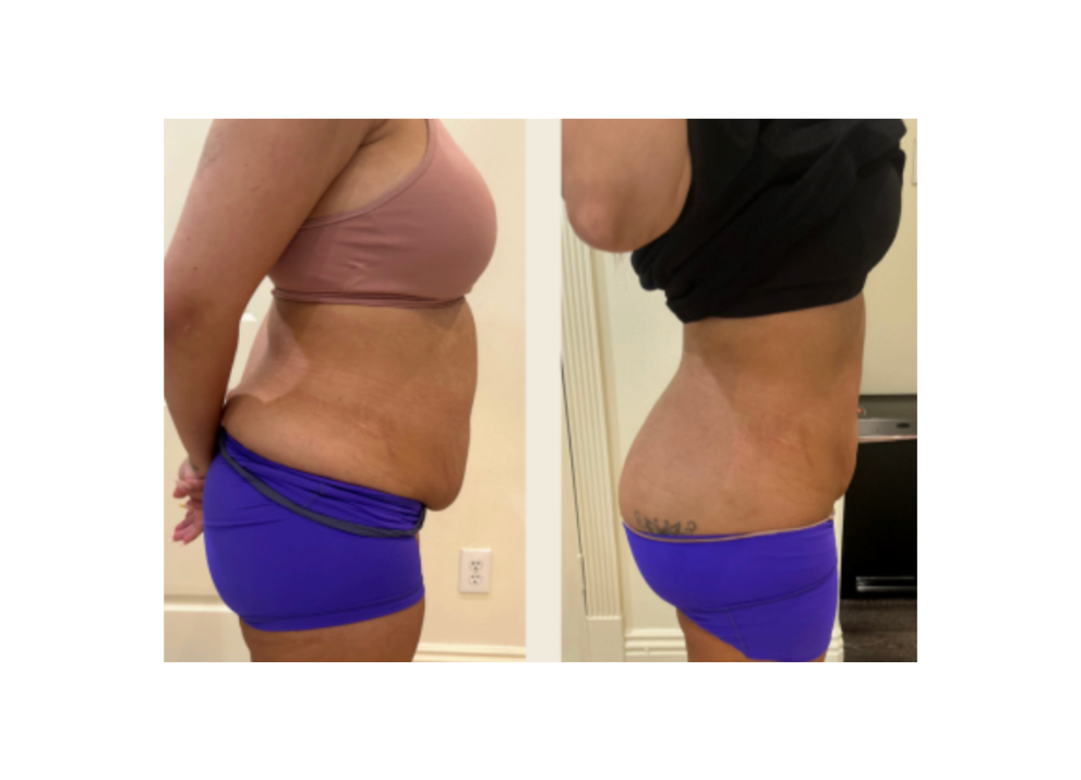 Side-by-side comparison of a person wearing a brown top and blue underwear on the left, and a black top and blue underwear on the right.